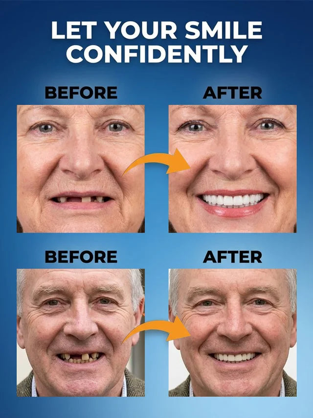 New generation of customized full-function dentures-MHW
