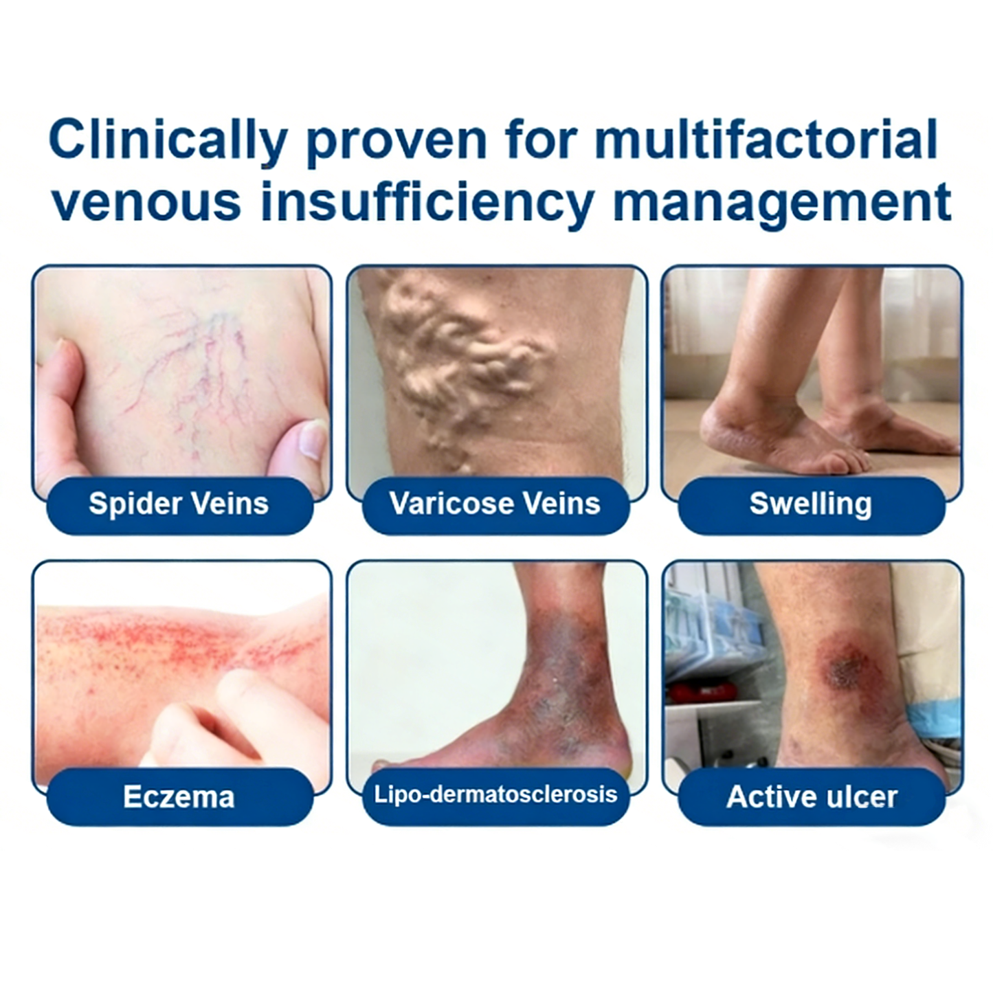 🌿 Hgfnvllc® Vein Contour Micro-Patch ✨ Diosmin & Hesperidin Leg Care Support