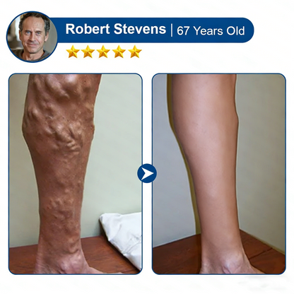 🌿 Hgfnvllc® Vein Contour Micro-Patch ✨ Diosmin & Hesperidin Leg Care Support