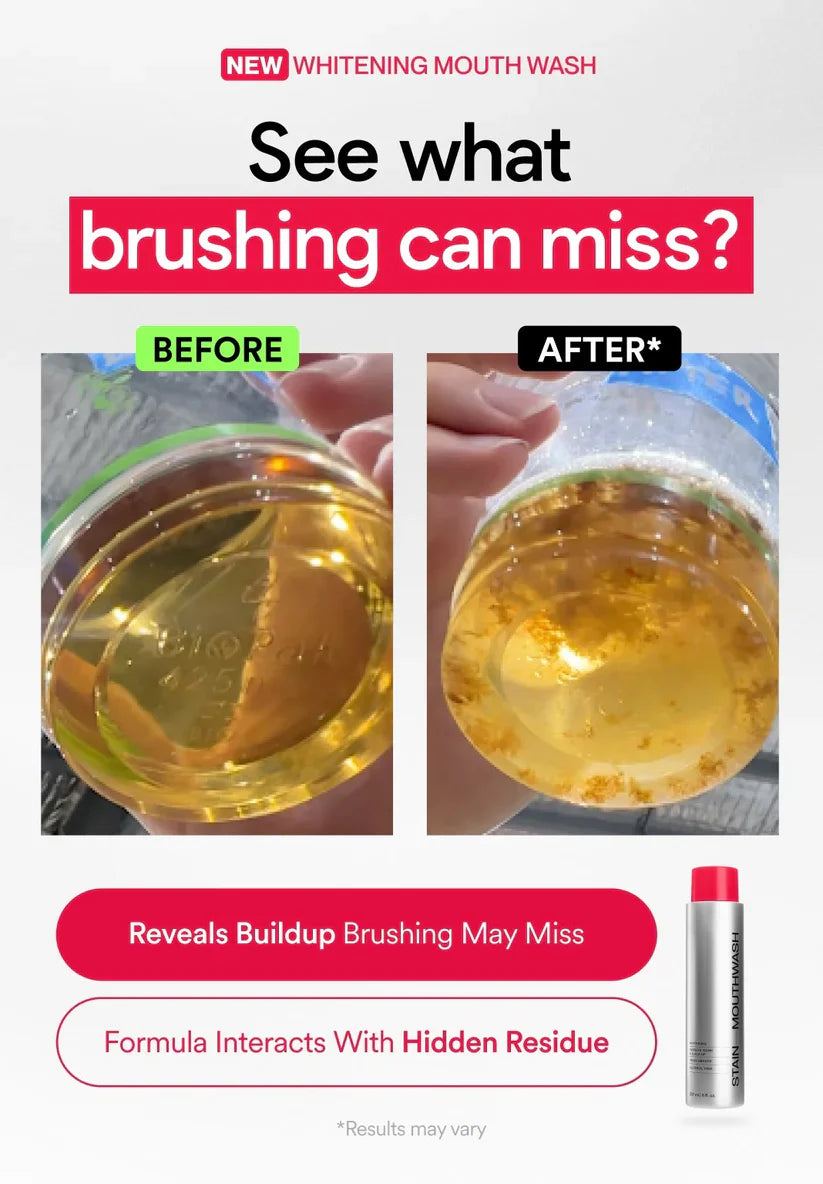 ✨Skavix Whitening Mouthwash – Stain Removal, Brighter Teeth & Fresh Breath