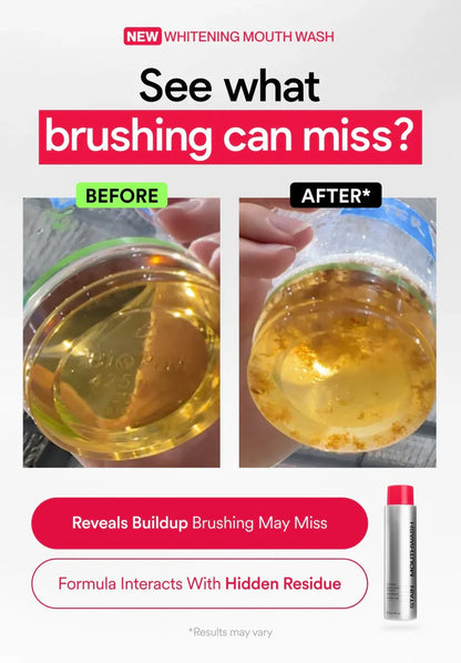 ✨Skavix Whitening Mouthwash – Stain Removal, Brighter Teeth & Fresh Breath