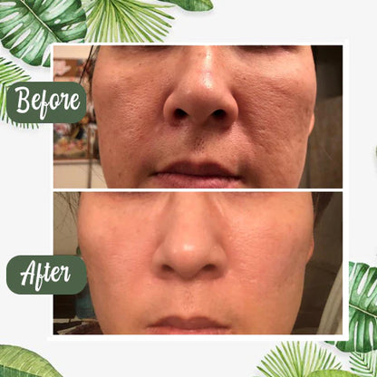 Hgfnvllc™ 100% Natural Green Tea Purifying Clay Mask