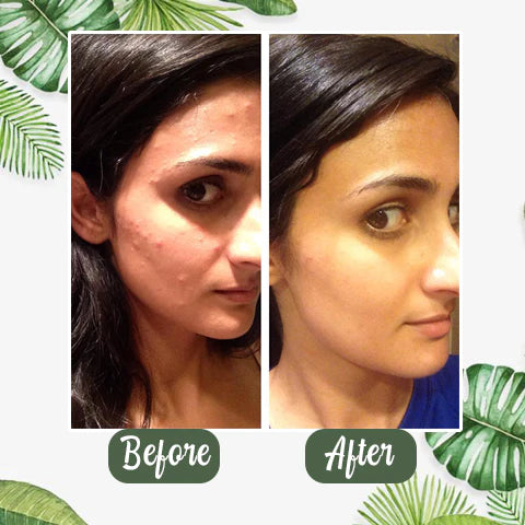 Hgfnvllc™ 100% Natural Green Tea Purifying Clay Mask