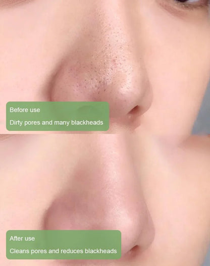 Hgfnvllc™ 100% Natural Green Tea Purifying Clay Mask