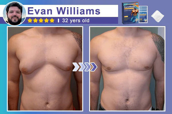 ⚕️💙Hgfnvllc® Gynecomastia Chest Fatburn & Firm Patch-MHW
